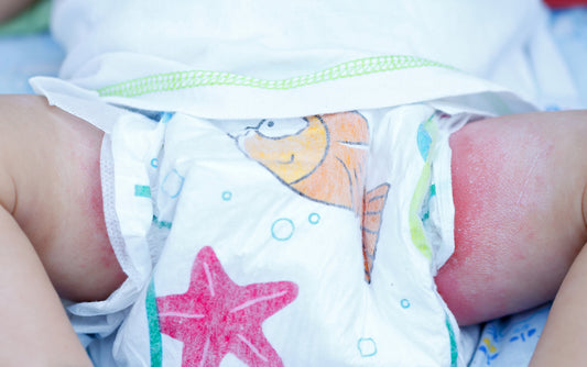 4 Tips for Diaper Rash Treatment