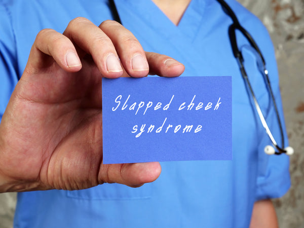 A doctor holding a blue card with the words "slapped cheek syndrome" on it. Slapped cheek syndrome can be the reason why your baby's cheeks are pink.