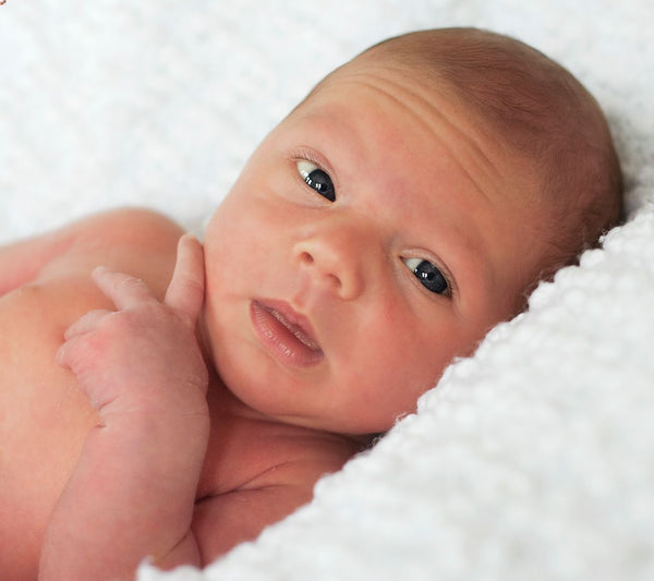 A newborn baby with dry skin.